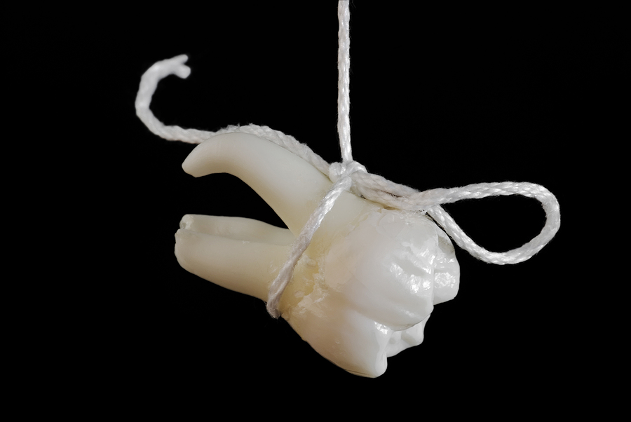 The Importance of Tooth Extractions for Oral Health