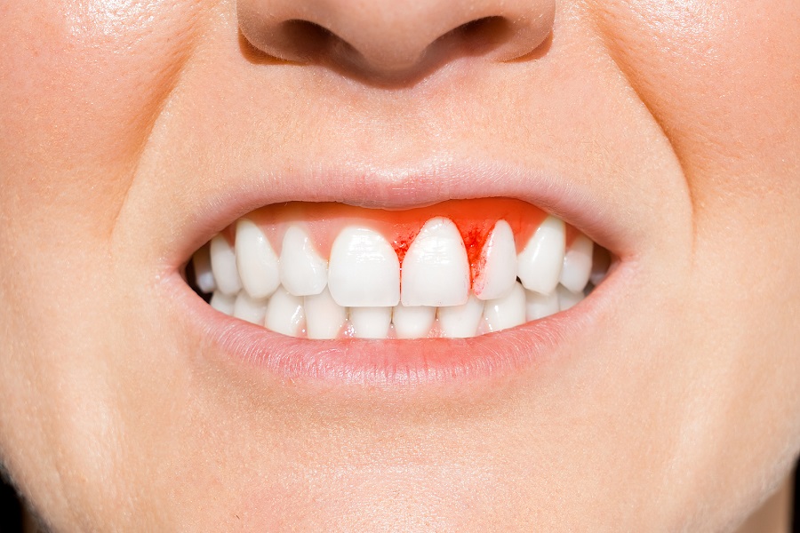 SEE YOUR EMERGENCY DENTIST IN AUSTIN WHEN YOUR SMILE IS IN TROUBLE