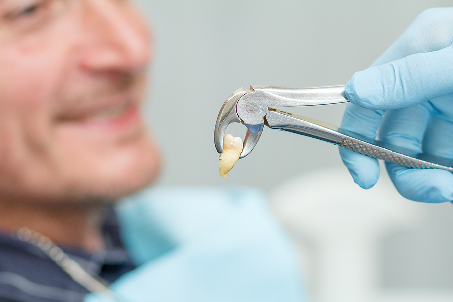 The Importance of Professional Tooth Extractions in Austin, TX: What You Need to Know